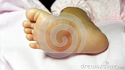 close-up newborn baby feet skin athleteâ€™s foot psoriasis fungus, hong kong foot, foot disease Stock Photo